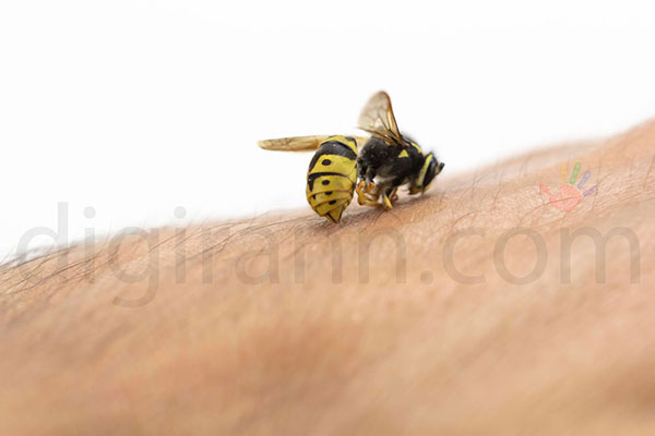 نمایی از نیش زنبورعسل بر روی پوست یک انسان